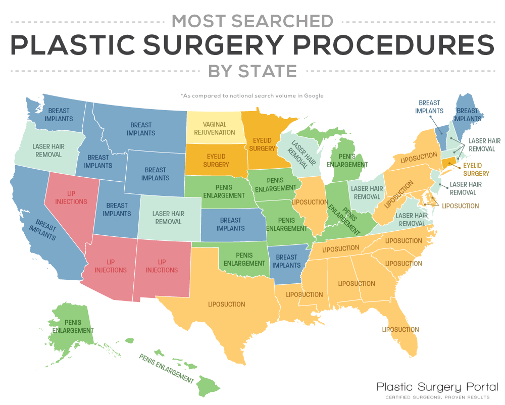 Most searched plastic surgery procedures by U.S. state Vivid Maps